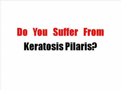 how to dissolve keratin plugs