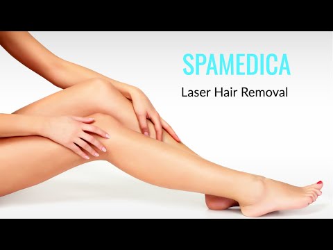 Video LightSheer Diode Laser (Hair Removal) in Toronto