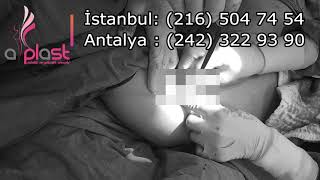 Gökhan Özerdem-46