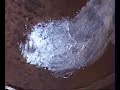 Part 9 - Shingles and wound treatment Part 9 - Shingles and wound treatment