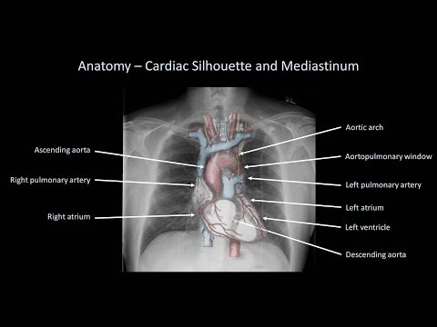 how to properly read a chest x ray