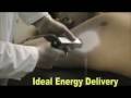 Laser Epilation Chapter 3 Client Preparation