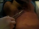 Stitching Kieran Up