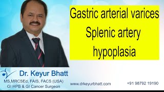 Gastric arterial varicel bleeding - Splenic artery hypoplasia - splenectomy 