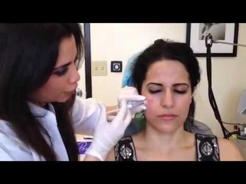 how to dissolve belotero