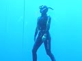 Apnea