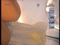 Alcon Cartidge D