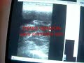 ultrasonido-gestacion-perro.html