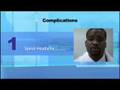 Lumbar Puncture