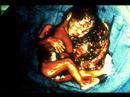 Pro-Life