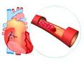 What causes a heart attack?