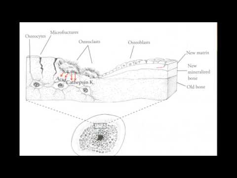 how to treat osteoporosis naturally