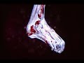 Blitz: The League II Injury (Dislocated Ankle)
