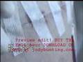 Tummy Tuck (Abdominoplasty) Video Diary Jody Bunting PREVIEW