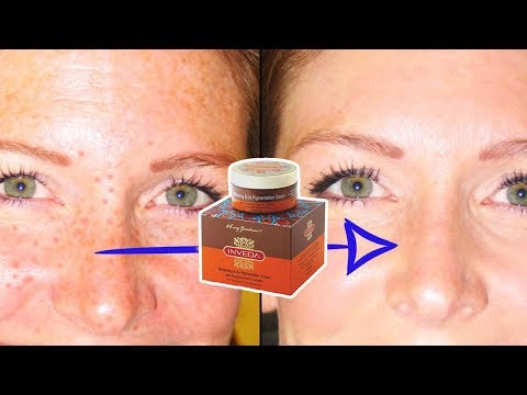 video-linktoworks-6 Best Creams To Get Rid Of FRECKLES/Pigmenation (Jhai)