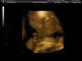 Alana Ultrasound