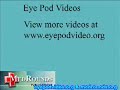 Mitomycin C Trabeculectomy & Trabeculotomy in Glaucoma
