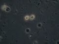 Prostatic fluid overveiw