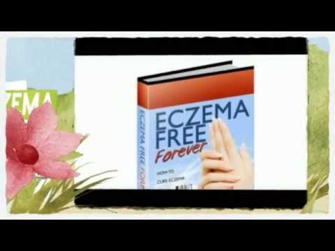 how to cure eczema on arms