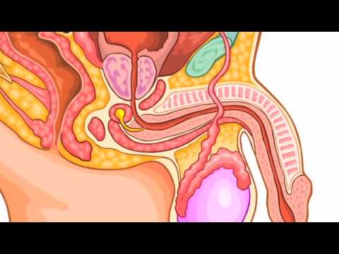 See video