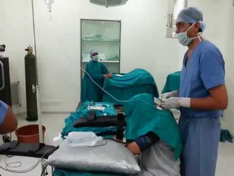 how to measure epidural catheter