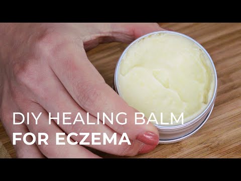 how to naturally heal eczema