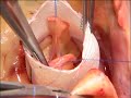 Tirone David by Dr Doisy MD Tonkin Clinique Tirone David by Dr Doisy MD Tonkin Clinique