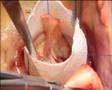 Tirone David by Dr Doisy MD Tonkin Clinique