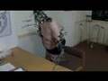 Metalosis Maligna. An Extraordinary disease