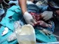 Maltese gives birth thru C-section