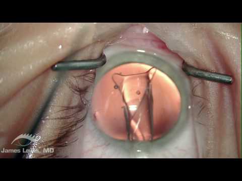 See video