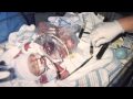 Donor Milk: Trailer