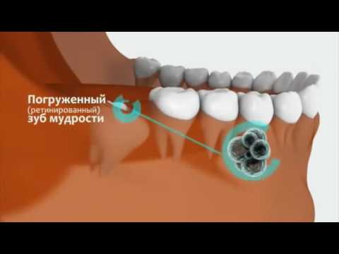 Рвотный рефлекс при чистке зубов: причины, что делать? Желтые пятна после стирки - Ремонт стиральных машин