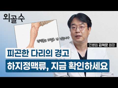 피곤한 다리의 경고, 하지 정맥류 지금 확인하세요!