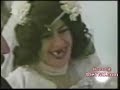 perdida de dientes perdida de dientes