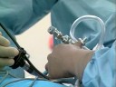 Vaginal Hysterectomy