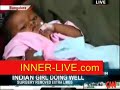 Indian girl has extra limbs removed