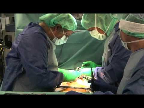 how to treat kyphoscoliosis