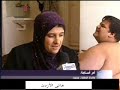 اغرب مرض طفل يتدخل العاهل السعودي لعلاجه / حالة لا تصدق