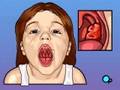 PreOp® Pediatric: Tonsillectomy Patient Education
