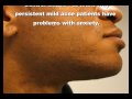 The Acne Practice  (Oily skin, Mild Acne, and Razor Bumps)