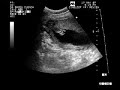 Fabiana alejandra mora teran 17-05-2007