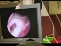 Vaginoscopie en blaasscopie bij een oudere hond met incontinentie klachten