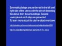 Laparoscopic Hysterectomy | Step 1 | Prof Zion Ben Rafael