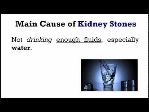 how to avoid kidney stones