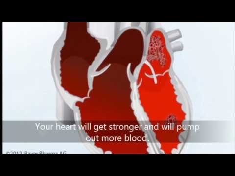 how to relieve heart pain