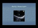 Chapter 3 - Cardiology - BRCH Lecture Series Chapter 3 - Cardiology - BRCH Lecture Series