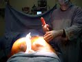 اجراء عمليات تجميل الانف وكافة التشوهات الولادية والمكتسبة والوجه وشد البطن والاطراف شفط الشحوم-تجميل الثدي تصغير او تكبير الثدي بالطرق الحديثة- زرع الشعر- ازلة الشعر والتجاعيد والوشم بالليزر-شد الوجه تجميل الاذن- تجميل الاجفان-حقن الدهون والبوتكس والريستالين-رفع الاورام الجلدية وعلاج اثار الحروق-جراحة اليد-drkhsh2001@yahoo.com009745742973الدكتور كمال حسين صالحاختصاصي جراحة التجميل والتكميل
