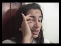 Thumbnail #1