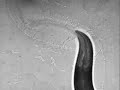 Eyeless C. elegans Worm Senses Light